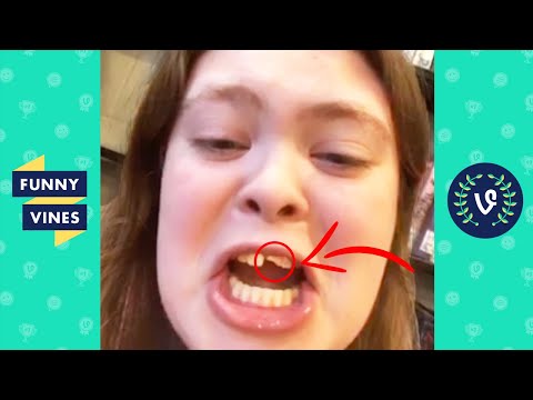 "SHE CHIPPED HER TOOTH! 😂" | TRY NOT TO LAUGH - FUNNY FAILS